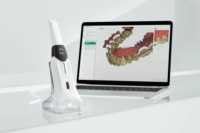 歯科診療のDXを加速させる口腔内スキャナー 「Straumann SIRIOS」2025